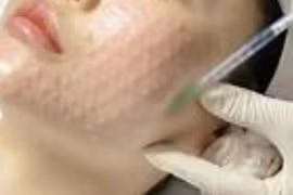 Cẩn trọng với 'bẫy' làm đẹp siêu tốc cận Tết