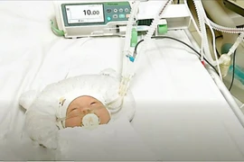 Phẫu thuật cấp cứu lấy thai suy hô hấp thành công