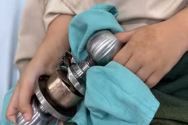 Bé trai vào viện cấp cứu cùng ổ khóa dính chặt ngón tay