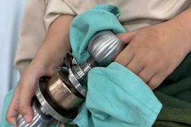 Bé trai vào viện cấp cứu cùng ổ khóa dính chặt ngón tay