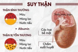 Sai lầm phổ biến khi điều trị suy thận khiến bệnh nặng hơn