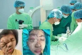 Cô gái trẻ thoát khỏi khối u khổng lồ sau 17 năm sống chung