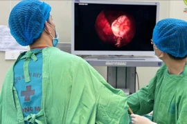 Răng mọc lạc chỗ vào xoang hàm, tình trạng hiếm gặp, có thể gây biến chứng