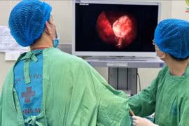 Răng mọc lạc chỗ vào xoang hàm, tình trạng hiếm gặp, có thể gây biến chứng