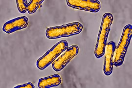 Vi khuẩn Listeria liên quan đến thực phẩm chế biến sẵn