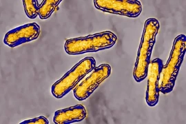 Vi khuẩn Listeria liên quan đến thực phẩm chế biến sẵn