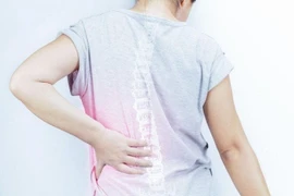 Thoát vị đĩa đệm âm thầm tấn công người trẻ