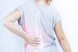 Thoát vị đĩa đệm âm thầm tấn công người trẻ