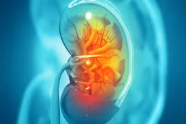 Viêm cầu thận có thể dẫn đến suy thận, biến chứng nguy hiểm