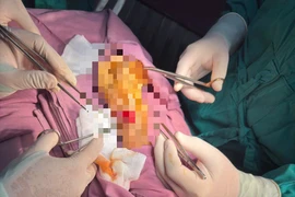 Cứu người phụ nữ bị đứt động mạch quay do dao cắt