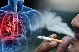 Ngăn ngừa ung thư qua kiểm soát yếu tố nguy cơ