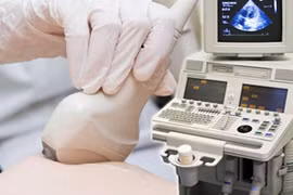 400 phụ nữ được tầm soát ung thư vú miễn phí