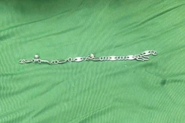 Bé gái 5 tuổi nuốt phải vòng tay bạc dài 7cm