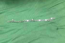 Bé gái 5 tuổi nuốt phải vòng tay bạc dài 7cm