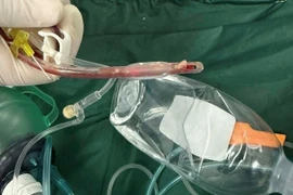 Vụ bé 3 tuổi tử vong sau khi sặc thức ăn, tạm ngưng hoạt động cơ sở mẫu giáo 