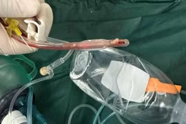 Vụ bé 3 tuổi tử vong sau khi sặc thức ăn, tạm ngưng hoạt động cơ sở mẫu giáo 