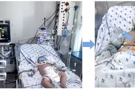 Cứu sống trẻ 7 tháng tuổi sốc sốt xuất huyết nặng