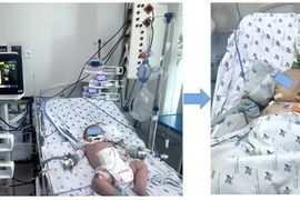 Cứu sống trẻ 7 tháng tuổi sốc sốt xuất huyết nặng