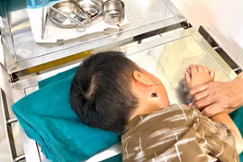 Điều trị thành công ca bệnh whitmore nguy hiểm ở trẻ 4 tuổi