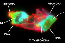 Phát hiện quan trọng có thể là nguyên nhân gây hội chứng Covid-19 kéo dài