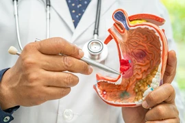 Người đàn ông ở Hà Nội đi khám đầy bụng, phát hiện ung thư dạ dày