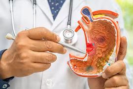 Người đàn ông ở Hà Nội đi khám đầy bụng, phát hiện ung thư dạ dày