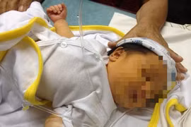 Phẫu thuật thành công cho trẻ 19 tháng mắc nang ống mật chủ hiếm gặp