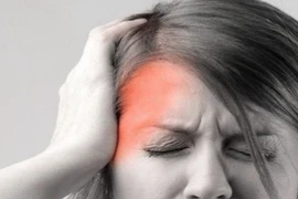 Phẫu thuật giải ép thần kinh cho bệnh nhân đau đầu suốt hơn 20 năm