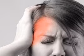 Phẫu thuật giải ép thần kinh cho bệnh nhân đau đầu suốt hơn 20 năm