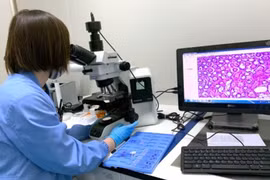 Xét nghiệm máu có thể phát hiện sớm nhiều loại ung thư