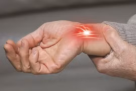 Phát hiện sớm hội chứng ống cổ tay, tránh tổn thương lâu dài