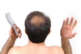 Nghiên cứu mới, đường deoxyribose có thể kích thích mọc tóc