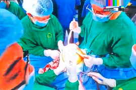 Phẫu thuật thay khớp gối toàn phần theo phương pháp bảo tồn cơ cho cụ bà