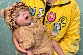 Trẻ sơ sinh 5 ngày tuổi bị thủng dạ dày, nhiễm khuẩn huyết vì mẹ cho ăn cơm