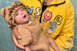 Trẻ sơ sinh 5 ngày tuổi bị thủng dạ dày, nhiễm khuẩn huyết vì mẹ cho ăn cơm