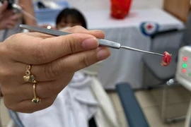 Sợi dây chun trong mũi bé trai 3 tuổi gây viêm mũi xoang nặng