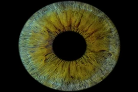 Ca ghép giác mạc in 3D đầu tiên trên người, giúp bệnh nhân mù lấy lại thị lực