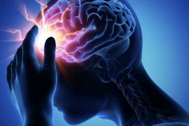 Đau thần kinh chẩm, nguyên nhân thường gặp gây đau đầu kéo dài