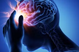 Đau thần kinh chẩm, nguyên nhân thường gặp gây đau đầu kéo dài