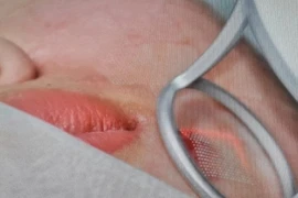 Cần biết gì về dịch vụ thẩm mỹ phi y tế để tránh rủi ro?