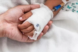 Não mô cầu có thể diễn tiến nặng chỉ trong 24 giờ 