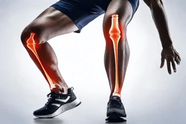 Thói quen giúp bảo vệ khớp gối, tránh nguy cơ thoái hóa, chấn thương 