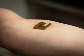 Một công cụ phát hiện ung thư da nhỏ gọn, không xâm lấn