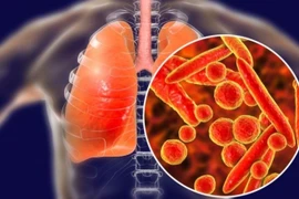 Nghiên cứu đột phá, CMX410 có thể thay thế kháng sinh trong điều trị lao