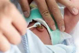 Bé trai 10 ngày tuổi nguy kịch do gia đình dùng kéo không vô trùng cắt rốn