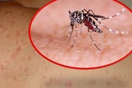 Hà Nội ghi nhận 190 trường hợp mắc sốt xuất huyết trong tuần qua