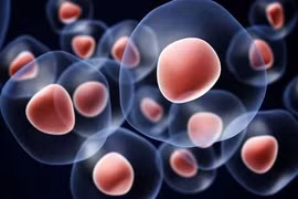 Trung Quốc tìm ra liệu pháp tế bào miễn dịch chữa ung thư 