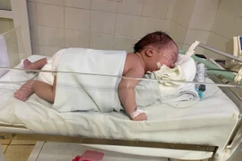 Cứu sống bệnh nhi mắc chứng mềm khí quản bẩm sinh 