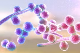 Dấu hiệu cảnh báo nhiễm nấm âm đạo