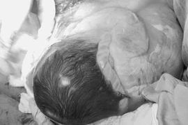 Bé chào đời trong bọc ối hiếm gặp